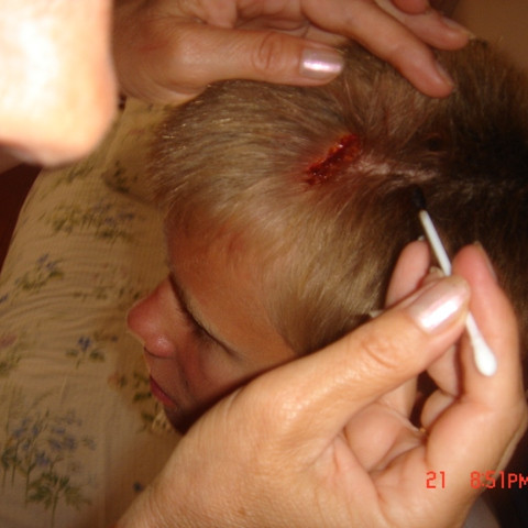 Freysteinn varð fyrir smá slysi í sundlauginni.